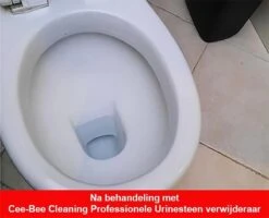 Urinesteen Pakket - Voor Het Verwijderen Van Urinesteen En Het Voorkomen Van Urinesteen - 1x Urinesteenoplosser - 2x Toiletreiniger -Ajax® Verkoop 1200x971